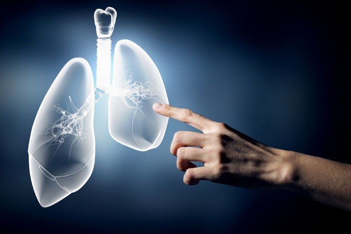 AKGÜN, Akciğer Kanserinin Erken Teşhisinde, Hem Hastaların Hem De Doktorların İşini Kolaylaştıracak Bir Sistem Geliştirdi. (Mayıs 2019, Karadeniz Ekspres)