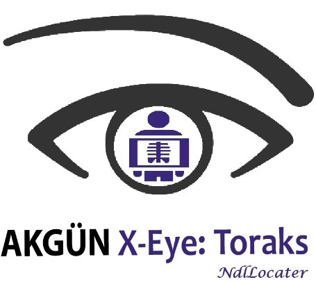 AKGÜN X-Eye Toraks: Türkiye’de Tek, Dünyada da Az Sayıda Olan Bir Sistemdir. (Mayıs 2019, Memleket Haber)